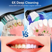 Escova de Dentes Elétrica Rotativa Thumbnail 4