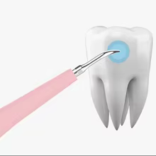 Escova de Dentes Sônica Portátil 2026 Thumbnail 4