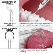 Bicos de Reposição para Irrigador Oral Thumbnail 6